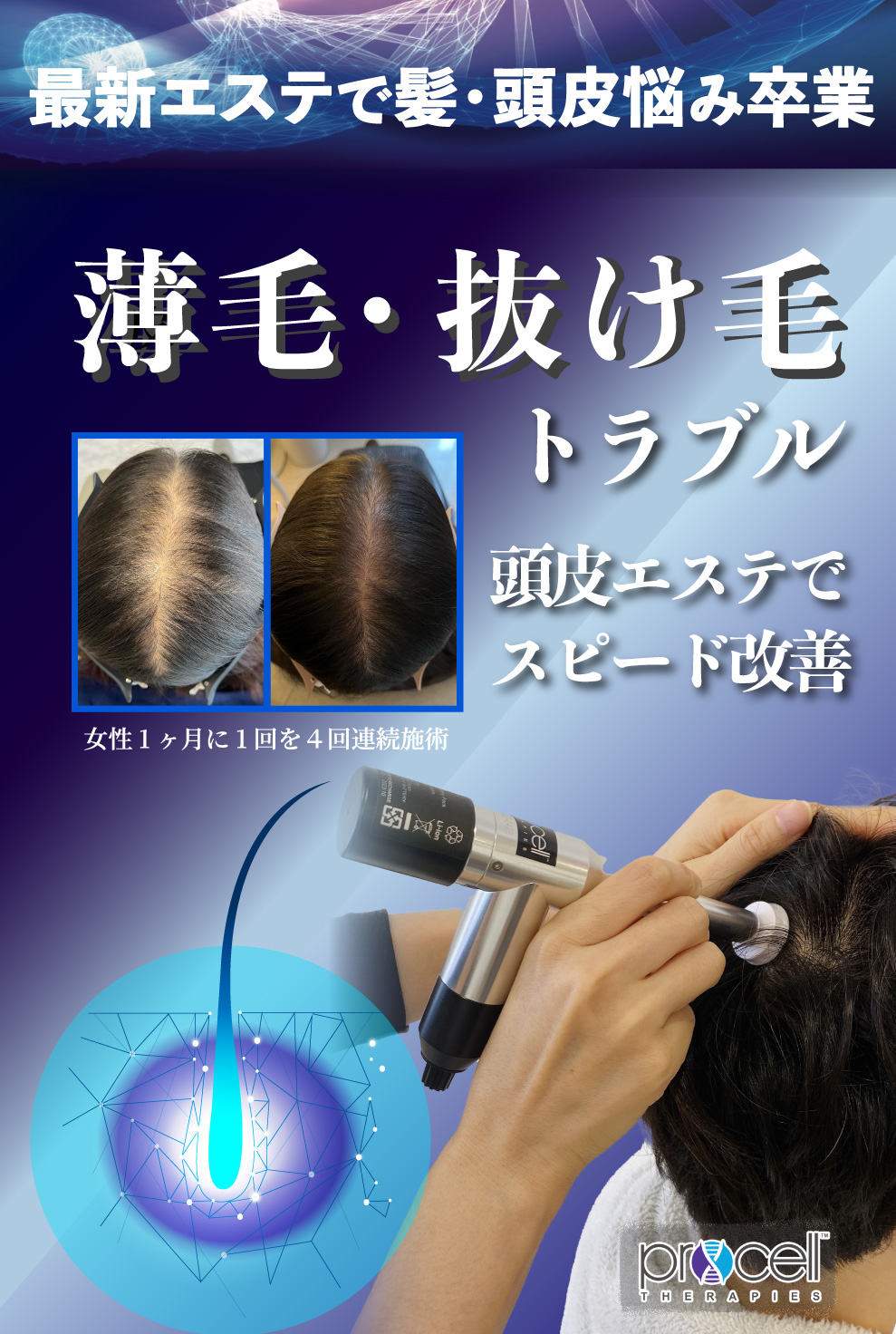 髪でもう悩まない。プロセルセラピーズは頭皮をスピード改善し、驚くほど元気にします。