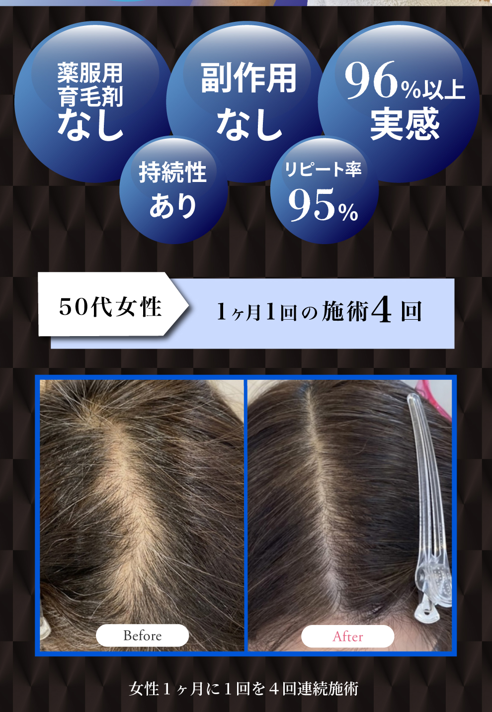 薬服用育毛剤なし。副作用なし。96％以上実感。