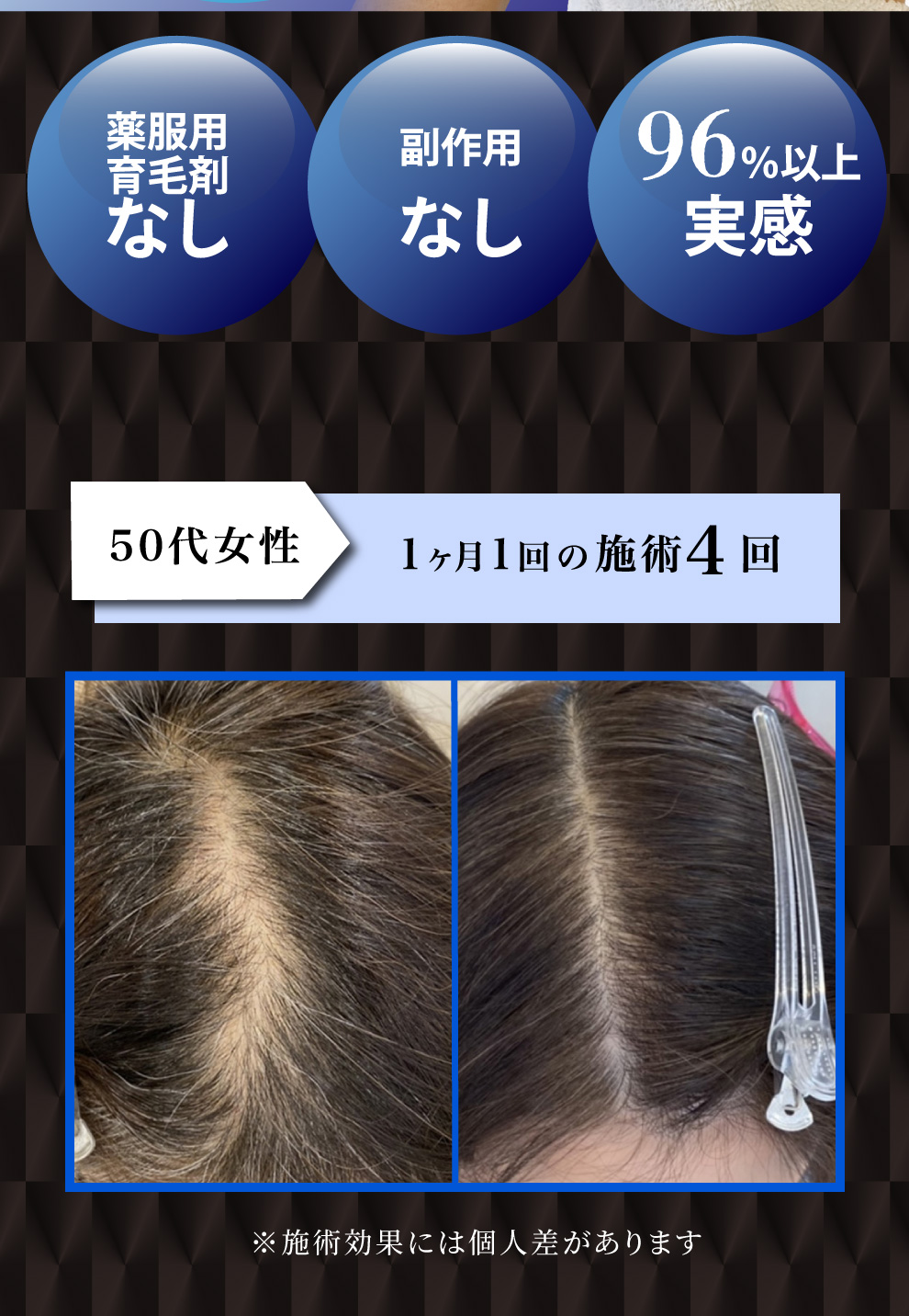 薬服用育毛剤なし。副作用なし。96％以上実感。
