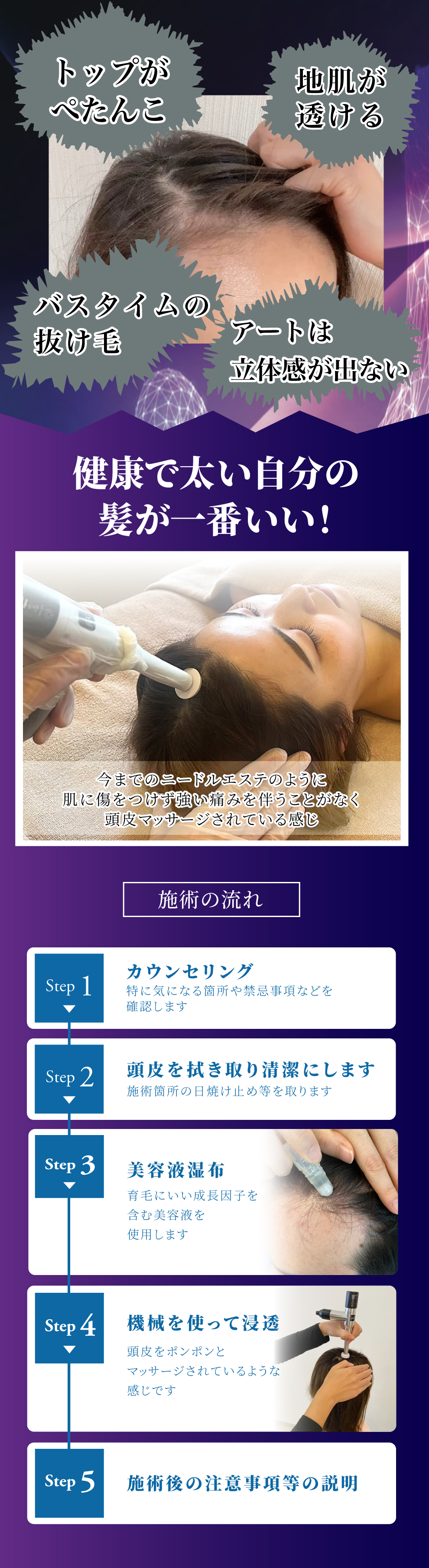 今までのニードルエステのように肌に傷をつけず強い痛みを伴うことがなく頭皮マッサージされている感じ