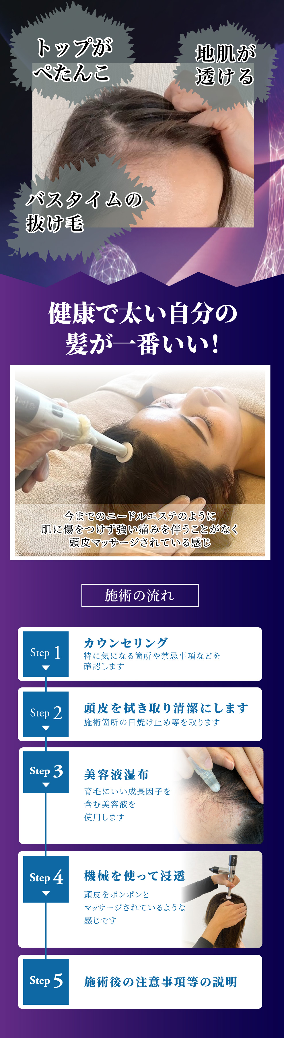 今までのニードルエステのように肌に傷をつけず強い痛みを伴うことがなく頭皮マッサージされている感じ